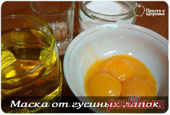 МАСКА от ГУСИНЫХ ЛАПОК !  **Жидкий мед 1с/л, пшен/мук а 1с/л, желток 1шт, масляный раствор витамина E.  
*Курс: через 2-3 дня, в течение 1- 2-х месяцев.   //Овкусе.ру