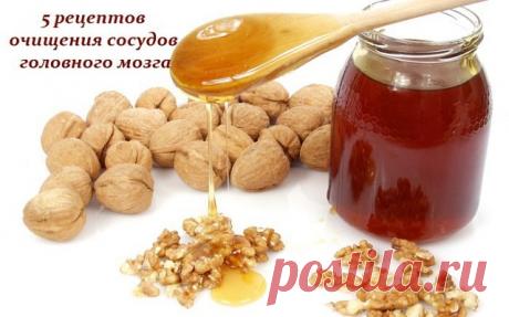 Очищение сосудов головного мозга очень важная процедура, которая способна значительно улучшить ваше самочувствие при ряде заболеваний, от остеохондроза шейного отдела до атеросклероза.

Регулярное очищение сосудов позволит вам избавиться от тяжести в голове, исчезнут головные боли, прояснится сознание, улучшится настроение. Мы подготовили для вас 5 эффективных и проверенных рецептов очищения сосудов головного мозга.

Очищение сосудов головного мозга – уникальные методики:
...
