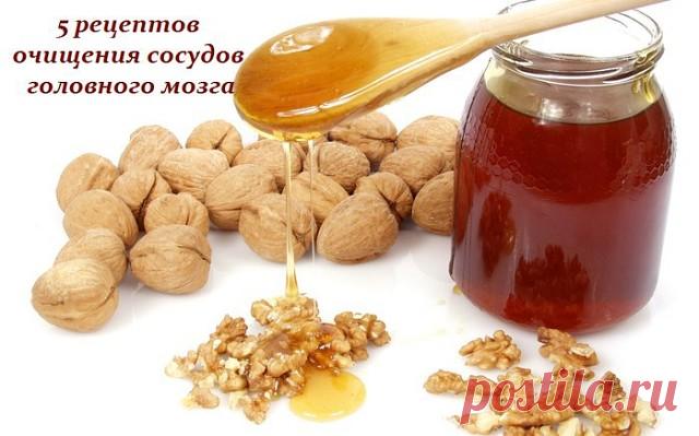 Очищение сосудов головного мозга очень важная процедура, которая способна значительно улучшить ваше самочувствие при ряде заболеваний, от остеохондроза шейного отдела до атеросклероза.

Регулярное очищение сосудов позволит вам избавиться от тяжести в голове, исчезнут головные боли, прояснится сознание, улучшится настроение. Мы подготовили для вас 5 эффективных и проверенных рецептов очищения сосудов головного мозга.

Очищение сосудов головного мозга – уникальные методики:
...