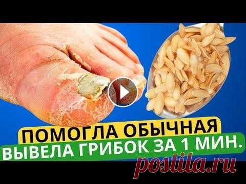 Эта ЯДРЁНАЯ Мазь Разъест Весь Грибок с Ногтей За 1 Минуту! Это точно есть у каждого дома! Сотрудничество - progresswayvideos@gmail.com ✎﹏﹏﹏﹏﹏﹏﹏﹏﹏﹏﹏﹏﹏﹏ ➤ВНИМАНИЕ! Канал носит исключительно информационный характер. Все рекомендации должны быт...