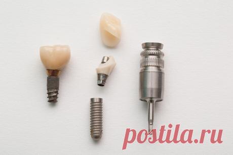 Имплантация зубов в Омске. Цены на имплантацию в 2022 году | Стоматология АлексДент