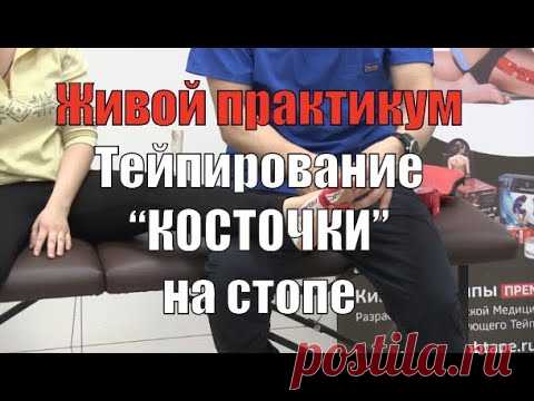 Тейпирование при 