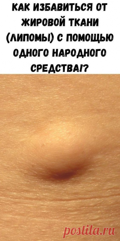 Изображение пина-истории