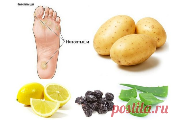 Избавляемся от мозолей и натоптышей