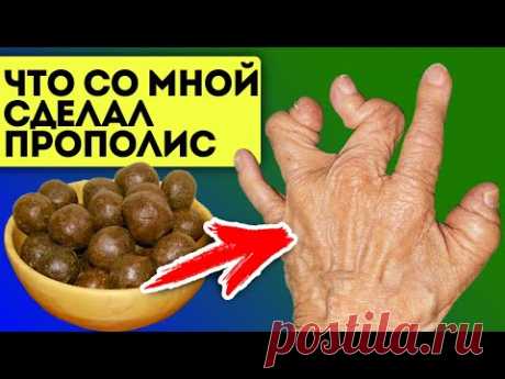 Что один шарик прополиса может сделать с организмом? Прополис для изменений