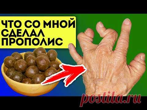Что один шарик прополиса может сделать с организмом? Прополис для изменений