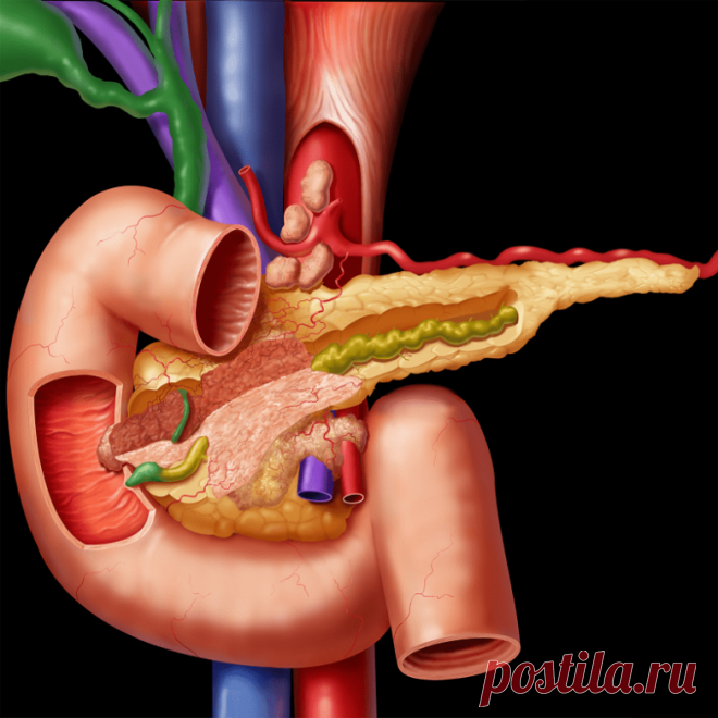 Дыхательные упражнения как профилактика панкреатита / Будьте здоровы