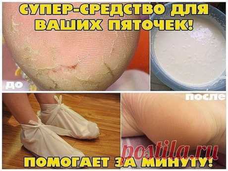 ✔ ПОЛЕЗНЫЕ СОВЕТЫ : Сохраните, чтобы не потерять. СОВЕТ 1 : СУПЕР-СРЕДСТВО ДЛЯ ВАШИХ ПЯТОЧЕК! ПОМОГАЕТ ЗА МИНУТУ! И так..... Берём небольшую мисочку (такого размера, чтобы только поместились в неё ноги), наливаем 1,5 литра воды , чтобы была горяченькая, но не очень. Добавляем в воду 4 столовых ложки перекиси водорода. Ставим ноги в воду и сидим. Уже через несколько минут создаётся такое впечатление, что вы парили ноги по крайней мере полчаса. Если подошвы очень запущены, п...
