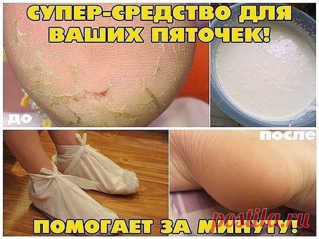 ✔ ПОЛЕЗНЫЕ СОВЕТЫ : Сохраните, чтобы не потерять. СОВЕТ 1 : СУПЕР-СРЕДСТВО ДЛЯ ВАШИХ ПЯТОЧЕК! ПОМОГАЕТ ЗА МИНУТУ! И так..... Берём небольшую мисочку (такого размера, чтобы только поместились в неё ноги), наливаем 1,5 литра воды , чтобы была горяченькая, но не очень. Добавляем в воду 4 столовых ложки перекиси водорода. Ставим ноги в воду и сидим. Уже через несколько минут создаётся такое впечатление, что вы парили ноги по крайней мере полчаса. Если подошвы очень запущены, п...
