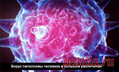 ВИРУС ПАПИЛЛОМЫ ЧЕЛОВЕКА ПРАКТИЧЕСКИ В 100% СЛУЧАЕВ ВЫЗЫВАЕТ РАК ШЕЙКИ МАТКИ И РАК КОЖИ!