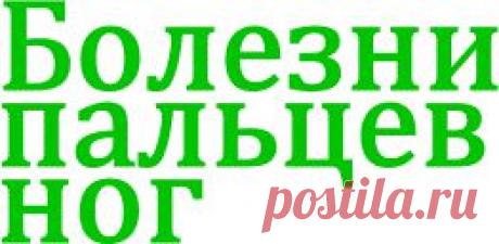 Грибок ногтей - лечение народными средствами грибка на ногах