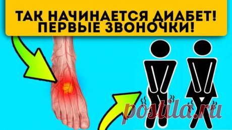 По каким признакам можно узнать, что у вас высокий сахар в крови