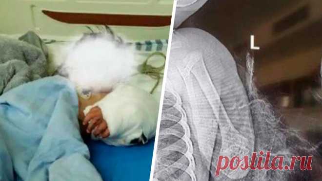 Домашний тибетский мастиф напал на ребенка и отгрыз ему предплечье. В Китае домашний тибетский мастиф напал на мальчика и откусил ему предплечье, пишет Asia One. Как пишут СМИ, обычно питомца держали на привязи, но в день инцидента отпустили, чтобы он смог поесть. Оказавшись на свободе, собака бросилась ...