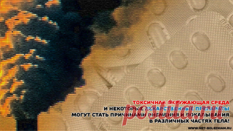 Почему немеют руки: 9 причин онемения и покалывания в разных частях тела 

Онемение и покалывания в различных зонах тела могут возникнуть из-за побочного эффекта на определенное лекарство. 

При влиянии токсичной окружающей среды у человека наблюдаются: онемение или покалывание рук или ног, тошнота, головная боль, головокружение.