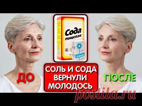 СОЛЬ и СОДА СТИРАЮТ МОРЩИНЫ ДАЖЕ В 70 ЛЕТ! Все думали что она колет БОТОКС