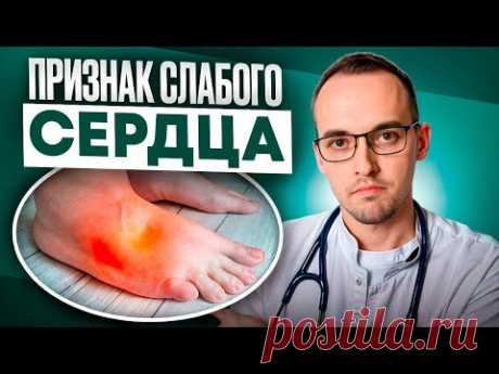 7 ПРИЗНАКОВ СЛАБОГО СЕРДЦА. Предотврати сердечную недостаточность, пока не поздно