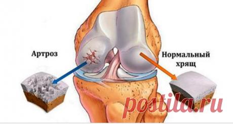 Эти 7 продуктов усиливают хрящи костей и быстро восстанавливают их!