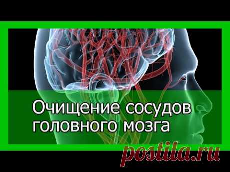 Очищение сосудов головного мозга народными средствами