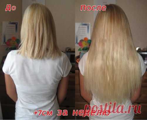 Мои читательницы часто спрашивают меня как я добилась что мои волосы такие длинные и главное здоровые. У меня действительно были проблемы с волосами, постоянно выпадали, секлись и не росли! Теперь все иначе, рассказываю тут как я добилась этого: ►►► http://drom.ru/redirect.php?url=vk.cc/3CVZ4P