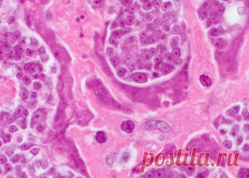 МИНЗДРАВ ЗАЯВЛЯЕТ: Неприятный запах изо рта из-за паразитов