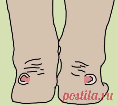 Она подержала ноги в ополаскивателе для рта 30 минут. То, что случилось потом, напоминает чудо!