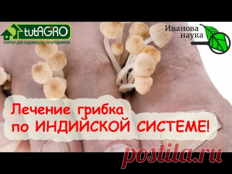 "НОГИ ИНДУСА" - СПОСОБ ПОЛНОГО ИЗЛЕЧЕНИЯ ГРИБКА НАТУРАЛЬНЫМИ СРЕДСТВАМИ!