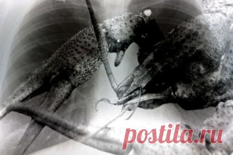 Как защитить себя от рака.Реальные советы.