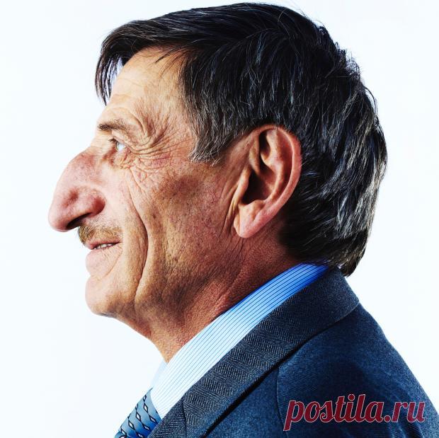 Житель Турции попал в Книгу рекордов Гиннесса как человек с самым длинным носом