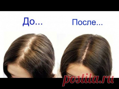 Эффективная маска от выпадения волос - YouTube
