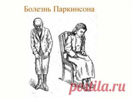 Болезнь Паркинсона. 
Болезнь Паркинсона – это неврологический недуг, поражающий возрастную категорию лиц. Характеризуется болезнь Паркинсона вяло прогрессирующим протеканием и причисляется к дегенеративным патологиям стр…