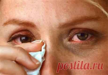 Конъюнктивит и как с ним бороться | Психология отношений. Красота и Здоровье