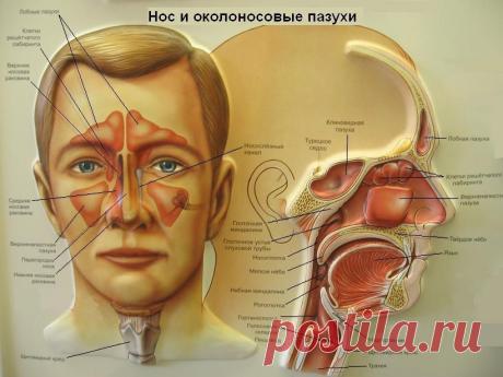Гайморит. Лечение гайморита дома. Народные методы лечения.