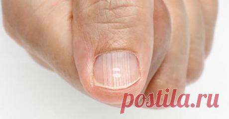 7 дефицитов, которые присутствуют практически у всех (и они об этом не знают) - Журнал для женщин