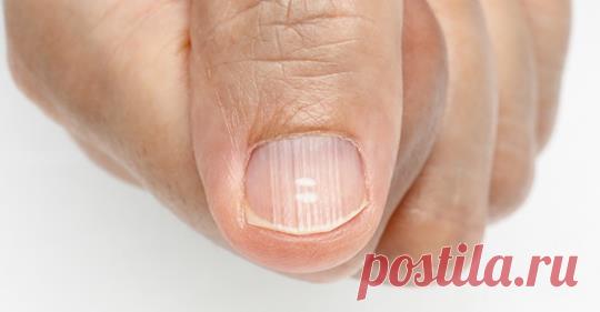 7 дефицитов, которые присутствуют практически у всех (и они об этом не знают) - Журнал для женщин