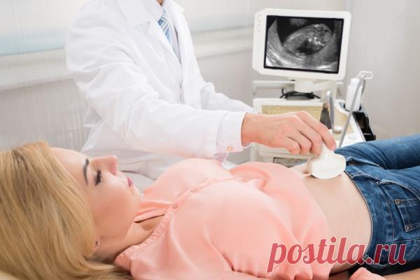 Киста яичника на УЗИ (фото): на какой день цикла делать и как, показания, подготовка, виды (дермоидная, после лапароскопии, эндометриоидная, желтого тела), нормы, возможные ошибки