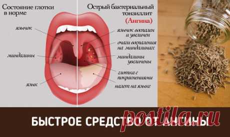 (94) Одноклассники