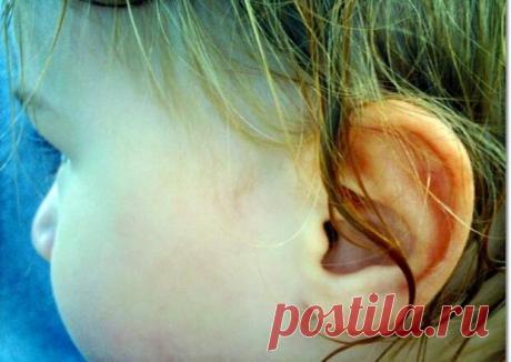 В медицинской среде есть такое понятие как «ухо пловца». Речь идет о тех ситуациях, когда вода попадает в орган слуха, но не выходит из него естественным образом. Вода может заблокировать слуховое отверстие после купания или промывания на целый день или даже неделю. Насколько это опасно, и что