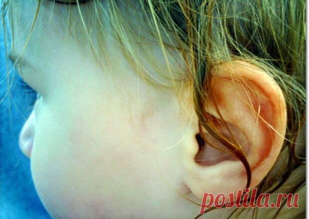 В медицинской среде есть такое понятие как «ухо пловца». Речь идет о тех ситуациях, когда вода попадает в орган слуха, но не выходит из него естественным образом. Вода может заблокировать слуховое отверстие после купания или промывания на целый день или даже неделю. Насколько это опасно, и что