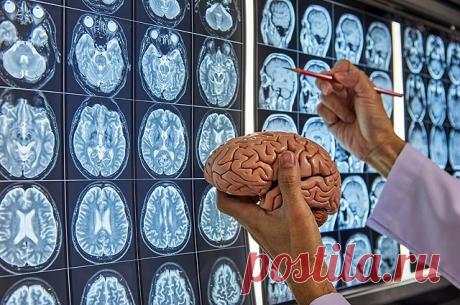 Держим в уме. 12 простых способов остановить деградацию мозга Если неправильно эксплуатировать мозг, то заболеешь. Но есть способы поддержать функцию мозга как можно дольше.