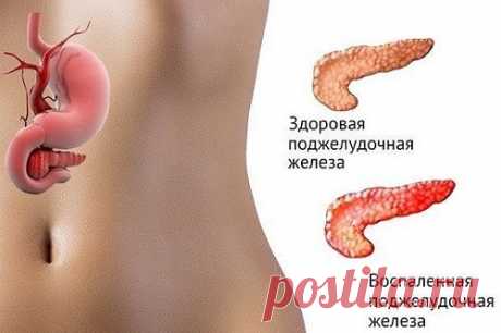 7 рецептов лечения поджелудочной железы Нарушение работы внутренних органов человека негативно сказывается на состоянии его здоровья. Когда появляются проблемы с пищеварением, уровень сахара в крови повышается, то такие симптомы говорят о неполадках в работе поджелудочной железы...