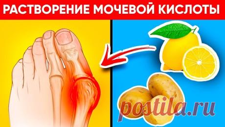 10 продуктов растворят кристаллы мочевой кислоты и избавят от подагры, камней в почках, болей в суставах! — Полезные советы