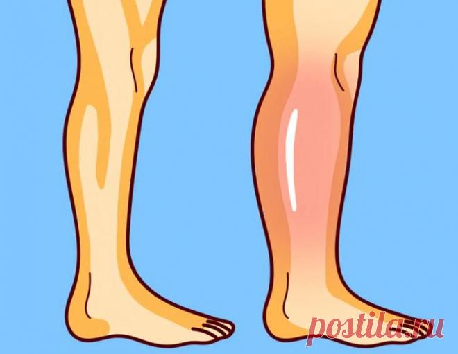 Упражнения от остеопата для снятия отёков ног