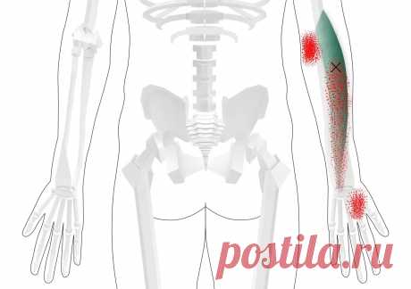 Плечелучевая мышца. Самомассаж