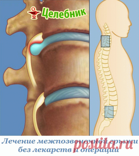 (7) Одноклассники