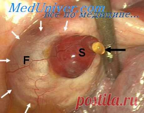 Овуляция и ее причины. Как происходит овуляция?