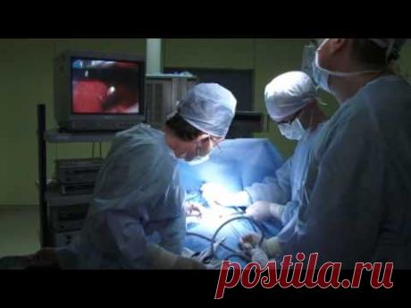 узловой зоб операция