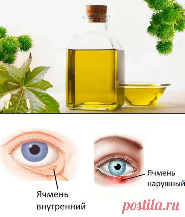 Как в домашних условиях быстро вылечить ячмень на глазу — Бабушкины секреты