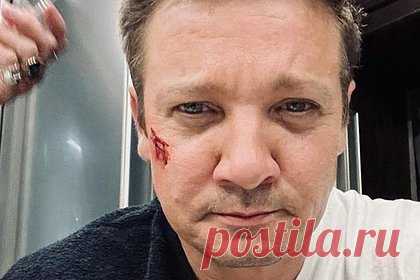 Попавшую в ДТП звезду «Мстителей» выписали из больницы. Звезда «Мстителей» и двукратный номинант на премию «Оскар» Джереми Реннер сообщил, что его выписали из больницы после несчастного случая, произошедшего 1 января. «После моего затуманенного состояния в период выздоровления я был очень рад посмотреть серию 201 вместе со своей семьей дома», — написал Реннер.