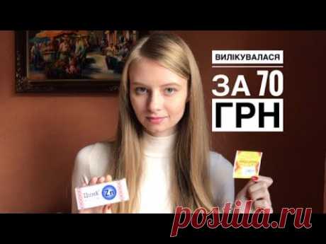 Чому не довіряю лікарям та що робила з ковідом: рецепт для людей здорового глузду