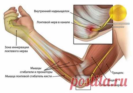 СИНДРОМ КУБИТАЛЬНОГО КАНАЛА (СИНДРОМ СДАВЛЕНИЯ ЛОКТЕВОГО НЕРВА). 

Нервы проводят импульсы от головного мозга и спинного мозга ко всем органам тела, и эти импульсы в том числе дают сигналы мышцам для движения и отвечают за чувствительность кожи. Когда нерв сдавливается, то, соответственно, он не может работать нормально и проводимость нервных импульсов нарушается. Естественно, нарушение проводимости нервных импульсов сильнее, когда давление на нерв больше. 
Показать полностью…